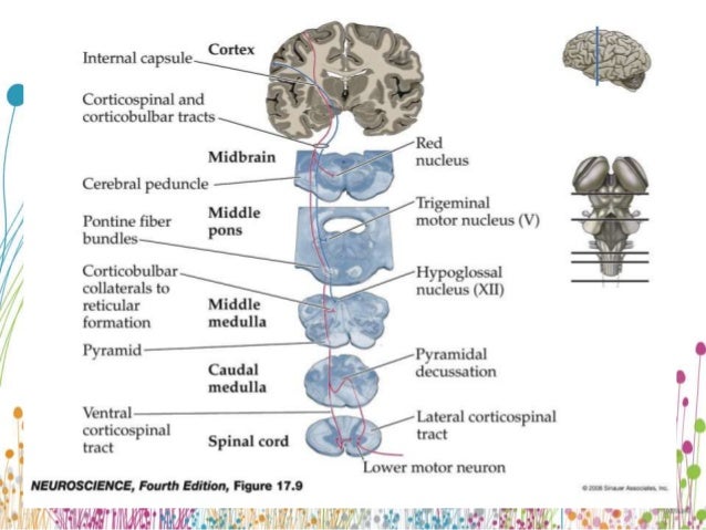 upper motor neuron lesion