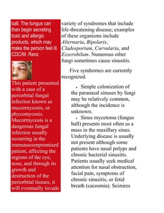 Upper Respiratory Infections