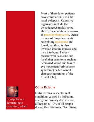 Upper Respiratory Infections