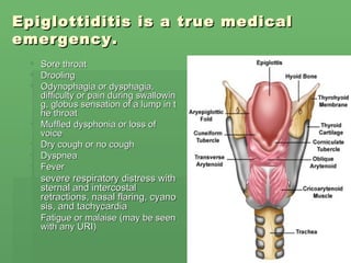Epiglottiditis is a true medical emergency. Sore throat  Drooling  Odynophagia or dysphagia, difficulty or pain during swallowing, globus sensation of a lump in the throat  Muffled dysphonia or loss of voice  Dry cough or no cough  Dyspnea  Fever  severe respiratory distress with sternal and intercostal retractions, nasal flaring, cyanosis, and tachycardia Fatigue or malaise (may be seen with any URI) 