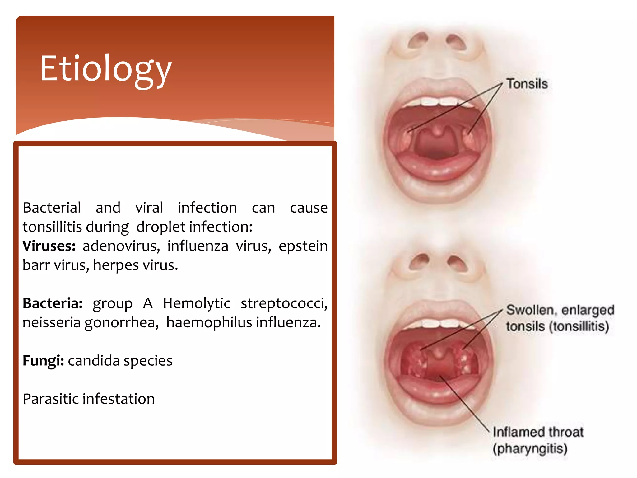 PEDIATRIC: Upper respiratory tract infectionS in children: SINUSITIS ...