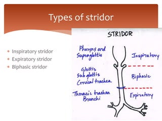 Stridor Scope PEDIATRIC: Upper respiratory tract infectionS in children: SINUSITIS ...
