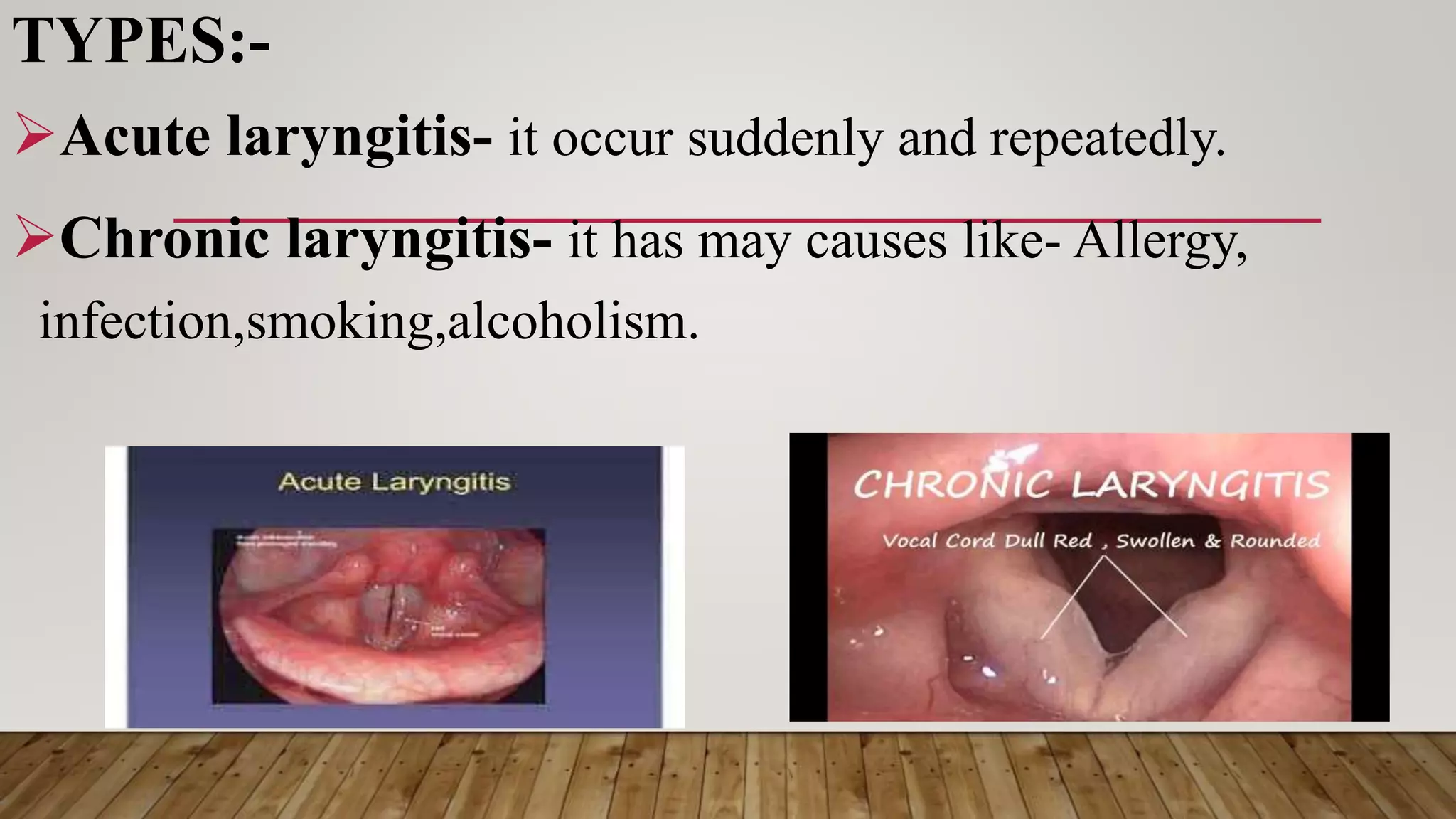 Upper respiratory tract infection.pptx