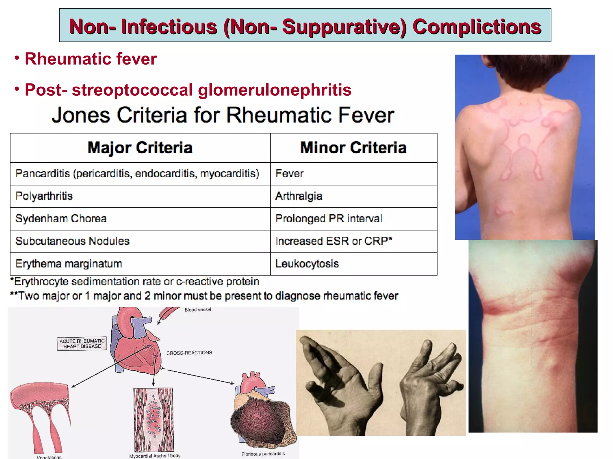 7 Upper respiratory tract infections | PPT