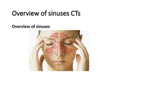 Overview of sinuses CTs
Overview of sinuses
 