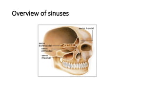 Overview of sinuses
 