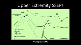 Upper Extremity SSEPs
Anurag Tewari MD
 