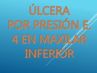 ÚLCERA POR PRESIÓN E. 4 EN MAXILAR INFERIOR.