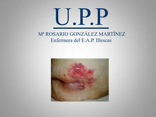 U.P.PMª ROSARIO GONZÁLEZ MARTÍNEZ
Enfermera del E.A.P. Illescas
 