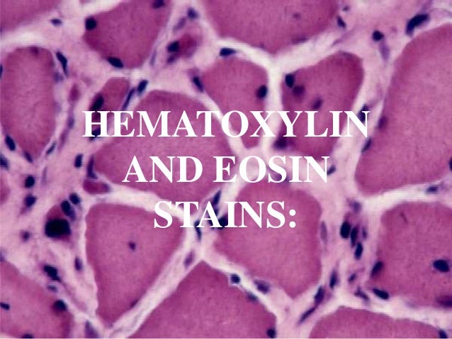 hematoxylin-and-eosin-stains