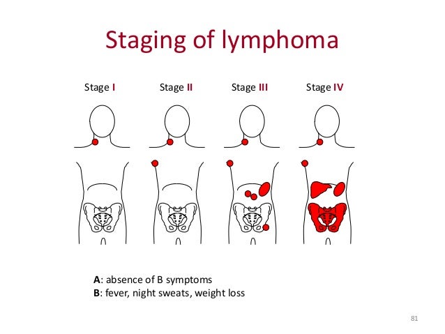 oral lymphoma