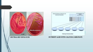 NUTRIENT AGER WITH CALCIUM CARBONATENEUTRAL RED INDICATOR
 
