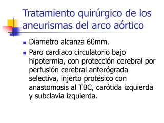 ENFERMEDADES DE LA AORTA | PPT