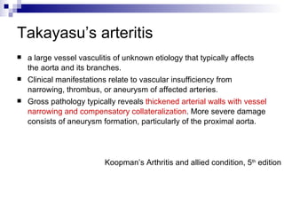 Takayasu’s arteritis ,[object Object],[object Object],[object Object],Koopman’s Arthritis and allied condition, 5 th  edition 