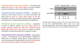 Comprehensive Overview of 2D Gel Electrophoresis in Proteomics and ...