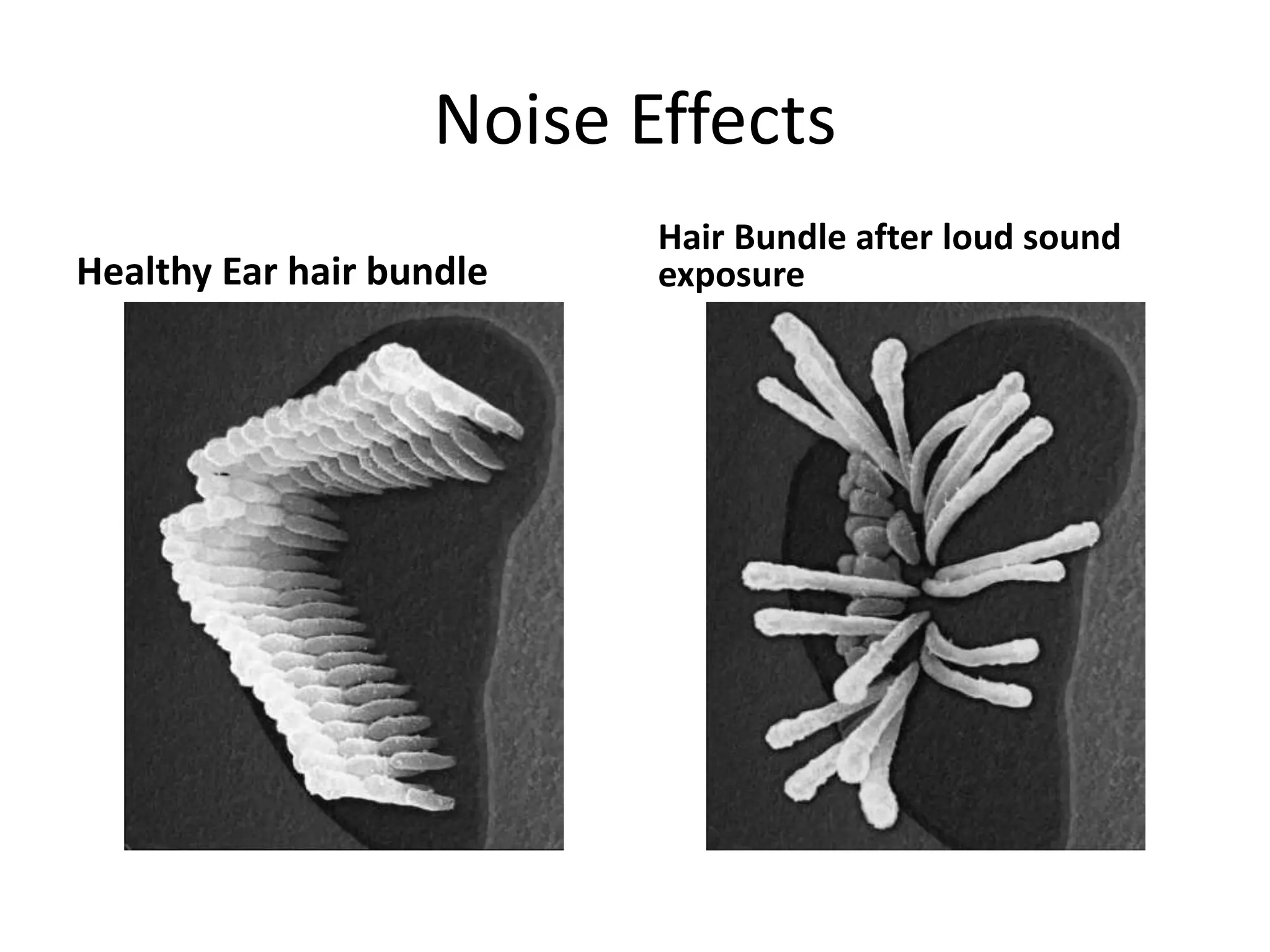Noise Effects
Healthy Ear hair bundle
Hair Bundle after loud sound
exposure
 