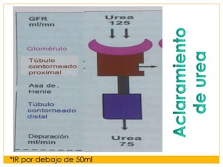 *IR por debajo de 50ml