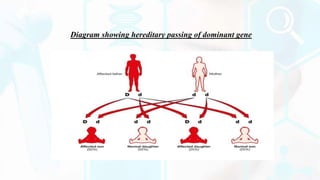 Diagram showing hereditary passing of dominant gene
 