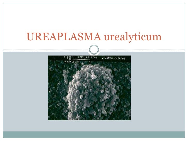 Sindrome da ureaplasma urealyticum: come si prende ...