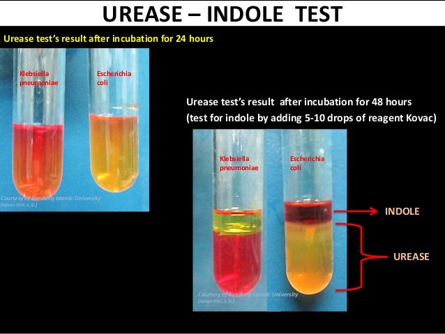 urease test