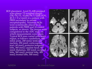 ROI placement. Axial FLAIR-prepped echo-planar T2-weighed images (TR/TE/TI, 10,000/91.7/2200; FOV, 40; b = 0 s/mm2) in a patient with PRES secondary to uremic encephalopathy. Nineteen ROIs were systemically placed in 22 patients with PRES and 18 control subjects, as shown. The images were coregistered to the ADC map, on which measurements were taken. Typical ROI sizes varied with brain region, as follows: cerebellum, 400 mm2; pons, 240 mm2; lenticular nucleus, 250 mm2; corticospinal tract, 60 mm2; posterior temporal lobe, 360 mm2; caudate head, 60 mm2; thalamus, 220 mm2; occipital lobe, 360 mm2; parietal lobe, 400 mm2; frontal lobe, 500 mm2.  