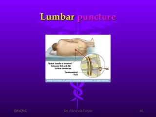 Lumbar  puncture 