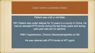 Patient was a 62 yr old Male.
HPI: Patient was under dialysis for 12 years in a county in China. He
had an elevated iPTH levels during the last three years and during
past year was put on calcitriol.
PMH: Hypertension, Chronic Glomerulonephritis on HD
He was referred with iPTH levels of 477 pg/ml
Case: Uremic Leontiasis Ossea
 
