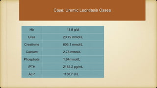 Hb 11.8 g/dl
Urea 23.79 mmol/L
Creatinine 606.1 mmol/L
Calcium 2.78 mmol/L
Phosphate 1.64mmol/L
iPTH 2183.2 pg/mL
ALP 1138.7 U/L
Case: Uremic Leontiasis Ossea
 