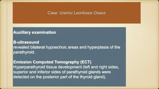 Case: Uremic Leontiasis Ossea
Auxillary examination
B-ultrasound
revealed bilateral hypoechoic areas and hyperplasia of the
parathyroid.
Emission Computed Tomography (ECT)
Hyperparathyroid tissue development (left and right sides,
superior and inferior sides of parathyroid glands were
detected on the posterior part of the thyroid gland).
 