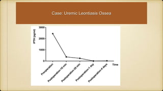 Case: Uremic Leontiasis Ossea
 