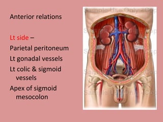 Anterior relations Lt side  – Parietal peritoneum Lt gonadal vessels Lt colic & sigmoid vessels Apex of sigmoid mesocolon 