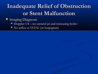 Inadequate Relief of Obstruction
or Stent Malfunction


Imaging Diagnosis



Doppler US – no ureteral jet and increasing hydro
No reflux at VCUG (or loopagram)

 