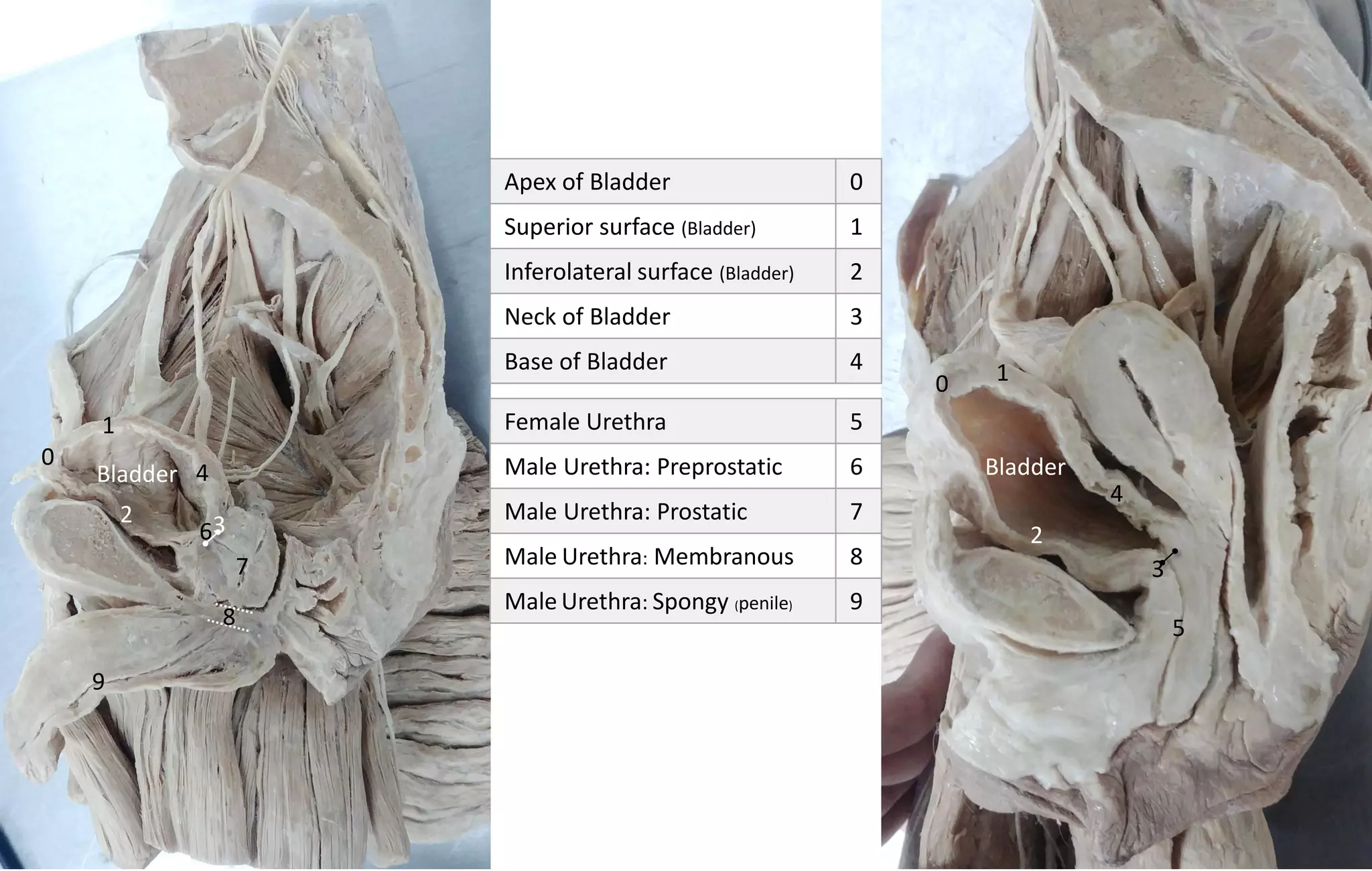 Apex of Bladder 0
Superior surface (Bladder) 1
Inferolateral surface (Bladder) 2
Neck of Bladder 3
Base of Bladder 4
0
0
1
1
2
2
3
3
4
4
5
6
7
9
8
BladderBladder
Female Urethra 5
Male Urethra: Preprostatic 6
Male Urethra: Prostatic 7
Male Urethra: Membranous 8
Male Urethra: Spongy (penile) 9
 