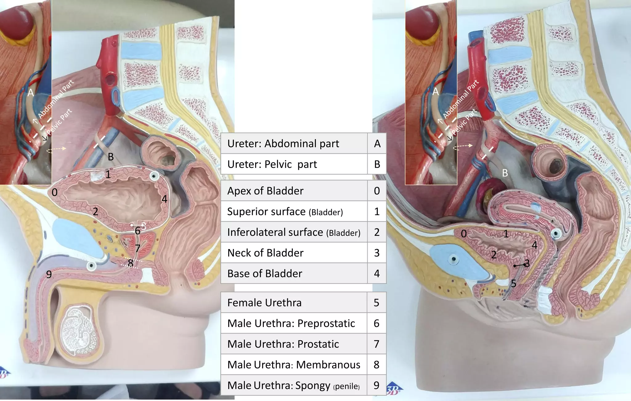 Apex of Bladder 0
Superior surface (Bladder) 1
Inferolateral surface (Bladder) 2
Neck of Bladder 3
Base of Bladder 4
Female Urethra 5
Male Urethra: Preprostatic 6
Male Urethra: Prostatic 7
Male Urethra: Membranous 8
Male Urethra: Spongy (penile) 9
0
0
1
1
2
2
3
4
4
3
5
6
7
8
9
A A
B
B
Ureter: Abdominal part A
Ureter: Pelvic part B
 