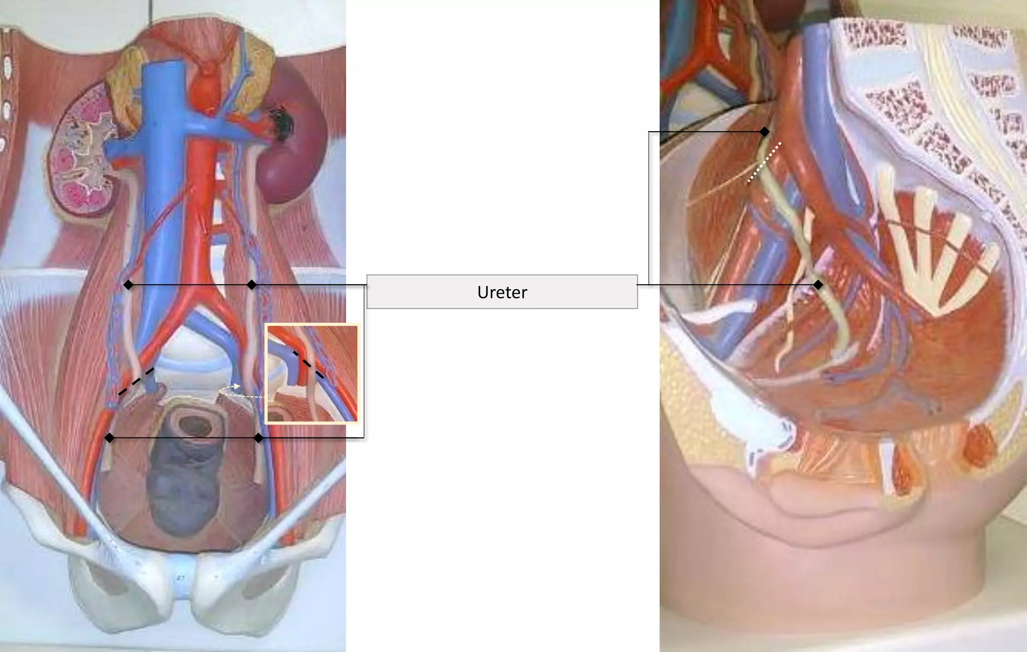 Ureter
 