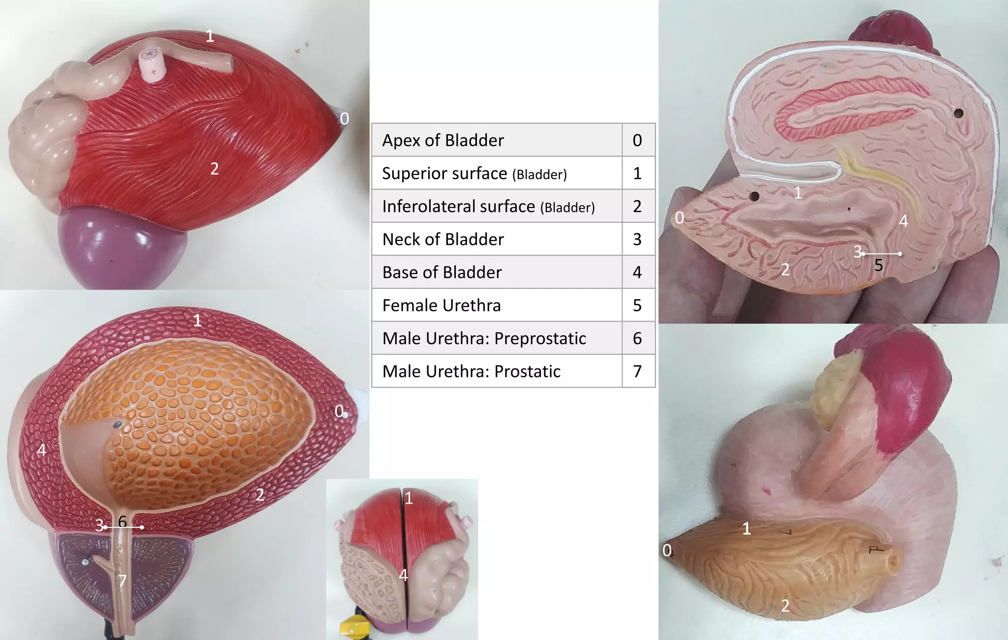 Apex of Bladder 0
Superior surface (Bladder) 1
Inferolateral surface (Bladder) 2
Neck of Bladder 3
Base of Bladder 4
Female Urethra 5
Male Urethra: Preprostatic 6
Male Urethra: Prostatic 7
1
12
2
2
2
4
4
4
5
6
7
3
3
0
0
0
0
 