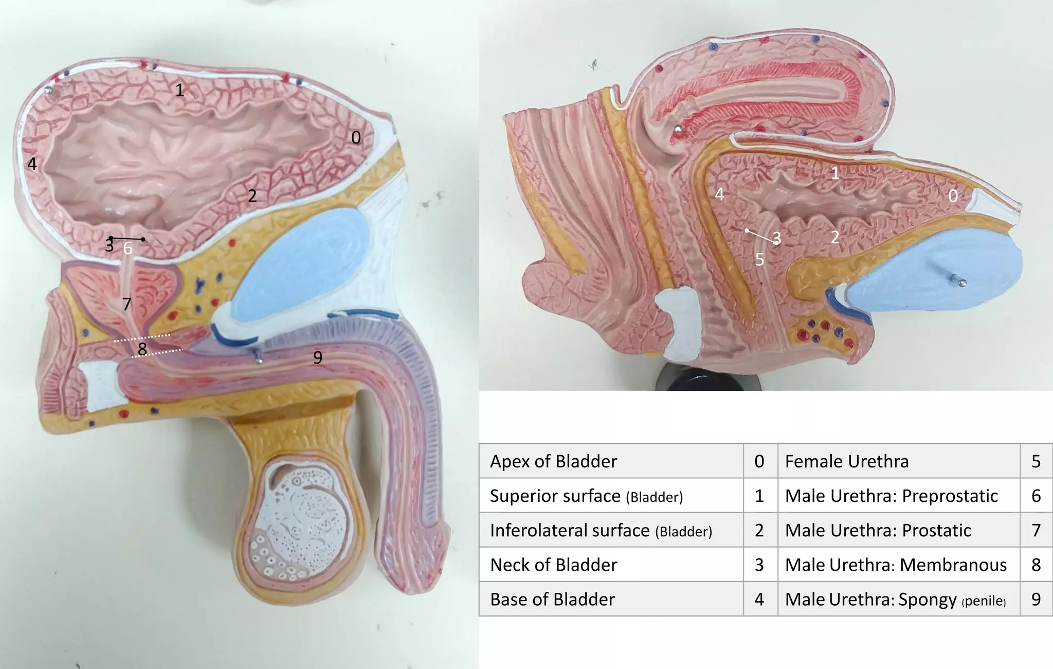 Female Urethra 5
Male Urethra: Preprostatic 6
Male Urethra: Prostatic 7
Male Urethra: Membranous 8
Male Urethra: Spongy (penile) 9
Apex of Bladder 0
Superior surface (Bladder) 1
Inferolateral surface (Bladder) 2
Neck of Bladder 3
Base of Bladder 4
0
0
1
1
2
23 3
4
4
5
6
7
8 9
 