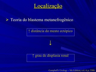 Localização Teoria do blastema metanefrogênico ↑  distância do meato ectópico ↓ ↑  grau de displasia renal Campbell’s Urology – 9th Edition; vol. 4; p. 3388. 