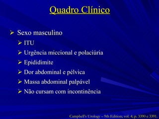 Quadro Clínico Sexo masculino ITU Urgência miccional e polaciúria Epididimite Dor abdominal e pélvica Massa abdominal palpável Não cursam com incontinência Campbell’s Urology – 9th Edition; vol. 4; p. 3390 e 3391. 
