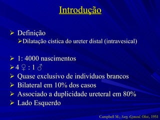 Introdução Definição Dilatação cística do ureter distal (intravesical) 1: 4000 nascimentos 4  ♀  : 1  ♂ Quase exclusivo de indivíduos brancos Bilateral em 10% dos casos Associado a duplicidade ureteral em 80% Lado Esquerdo Campbell M.;  Surg. Gynecol. Obst.,  1951 