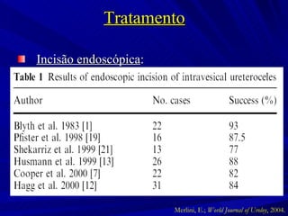 Tratamento Incisão endoscópica : Merlini, E.;  World Journal of Uroloy , 2004. 