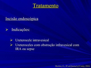Tratamento Incisão endoscópica Indicações: Ureterocele intravesical Ureteroceles com obstrução infravesical com IRA ou sepse Merlini, E.;  World Journal of Uroloy , 2004. 