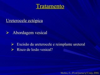 Tratamento Ureterocele ectópica Abordagem vesical Excisão da ureterocele e reimplante ureteral Risco de lesão vesical ? Merlini, E.;  World Journal of Uroloy , 2004. 