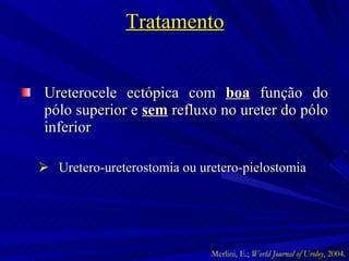 Tratamento Ureterocele ectópica com  boa  função do pólo superior e  sem  refluxo no ureter do pólo inferior Uretero-ureterostomia ou uretero-pielostomia  Merlini, E.;  World Journal of Uroloy , 2004. 