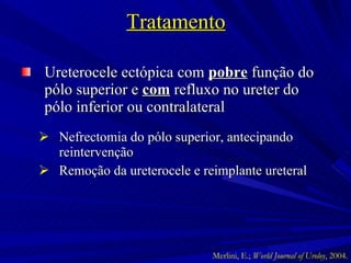 Tratamento Ureterocele ectópica com  pobre  função do pólo superior e  com  refluxo no ureter do pólo inferior ou contralateral Nefrectomia do pólo superior, antecipando reintervenção Remoção da ureterocele e reimplante ureteral Merlini, E.;  World Journal of Uroloy , 2004. 