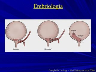Embriologia Campbell’s Urology – 9th Edition; vol. 4; p. 3386. 