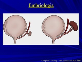 Embriologia Campbell’s Urology – 9th Edition; vol. 4; p. 3387. 