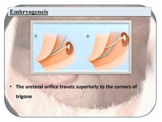 Embryogeneis
• The ureteral orifice travels superiorly to the corners of
trigone
 