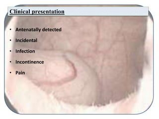 Clinical presentation
• Antenatally detected
• Incidental
• Infection
• Incontinence
• Pain
 