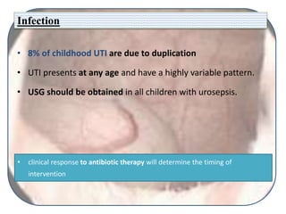 Infection
• 8% of childhood UTI are due to duplication
• UTI presents at any age and have a highly variable pattern.
• USG should be obtained in all children with urosepsis.
• clinical response to antibiotic therapy will determine the timing of
intervention
 